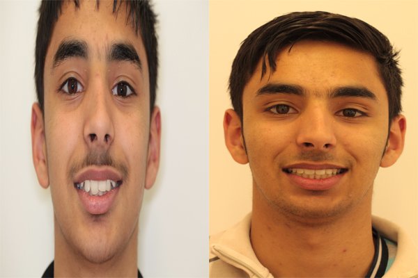 glenview dental treatment